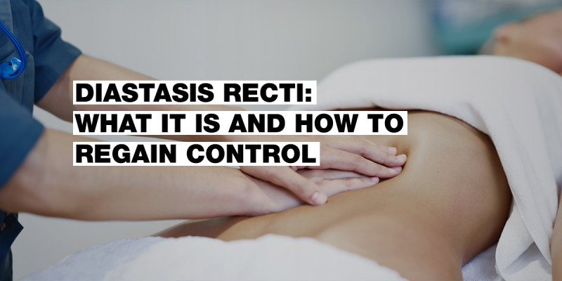 Diastasis: What It Is and How to Manage It