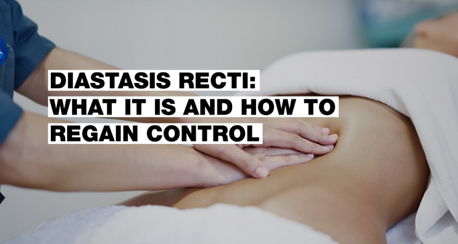 Diastasis: What It Is and How to Manage It | NEBBIA